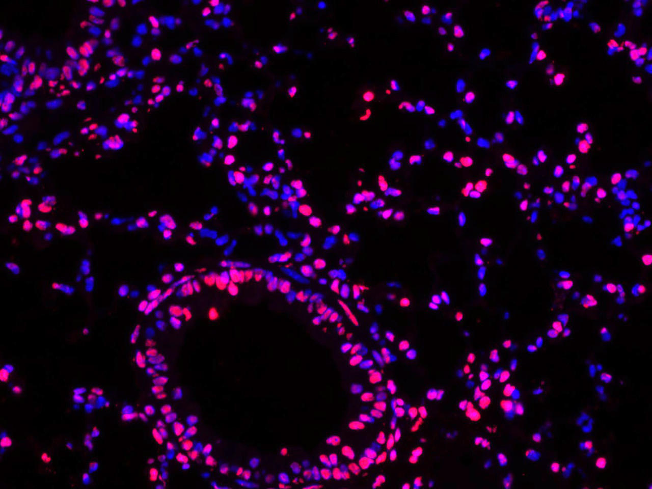 Paraffin embedded mouse lung was treated with DNase I to fragment the DNA. DNA strand breaks showed intense fluorescent staining in DNase I treated sample (red). The cells were counterstained with DAPI (blue).