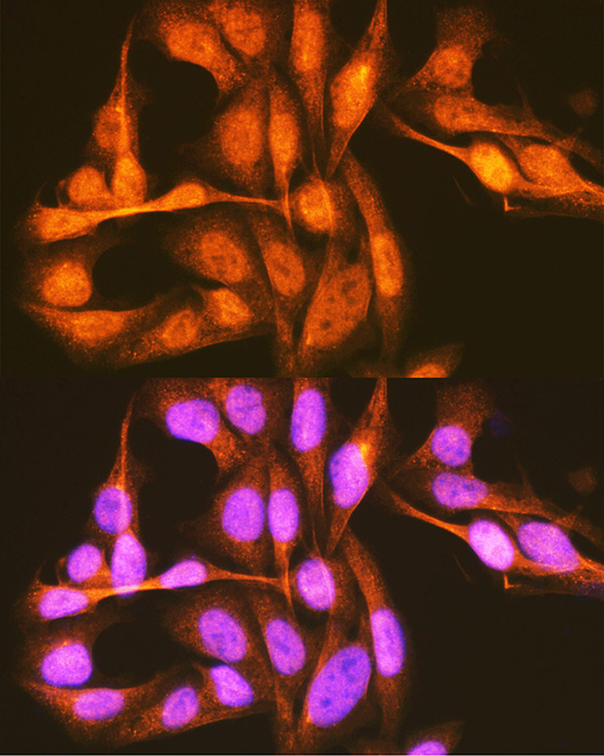 Anti-PCBP1 Antibody (CAB1044)