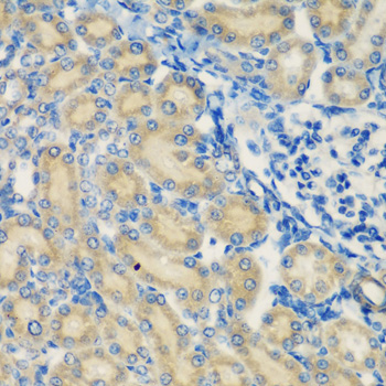 Anti-C1S Antibody (CAB6878)