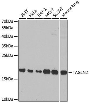 Anti-TAGLN2 Antibody [KO Validated] (CAB6761)