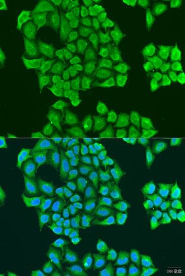 Anti-Synaptotagmin-11 Polyclonal Antibody (CAB8198)