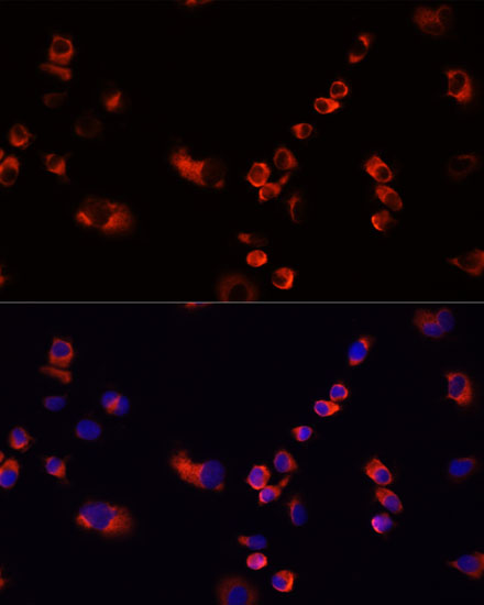 Anti-EEF1G Antibody (CAB2721)