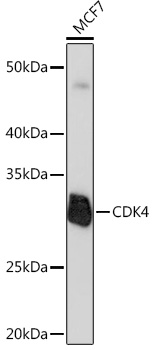 Anti-CDK4[KO Validated] Antibody