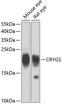 Anti-CRYGS Antibody (CAB7888)