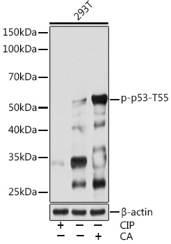 Anti-Phospho-p53-T55 Antibody (CABP0986)