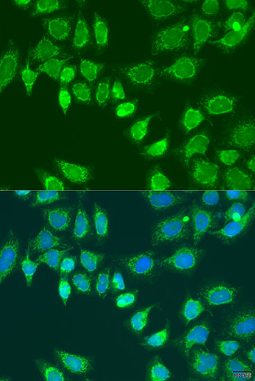 Anti-L2HGDH Antibody (CAB15192)