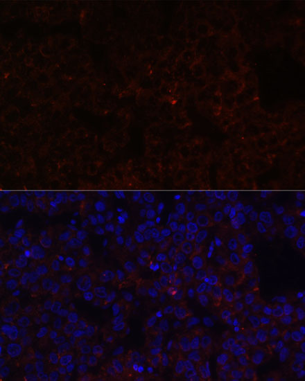 Anti-NNMT Antibody (CAB6673)