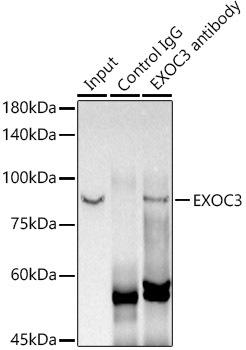 Immunoprecipitation analysis of 300ug extracts of MCF7 cells using 3ug EXOC3 antibody . Western blot was performed from the immunoprecipitate using EXOC3 antibody at a dilition of 1:1000.