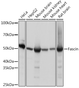 Anti-Fascin Antibody (CAB9566)