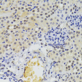 Anti-HNRNPA1 Antibody (CAB7491)