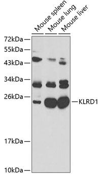 Anti-KLRD1 Antibody (CAB2039)