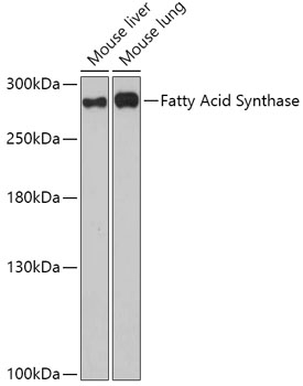 Anti-Fatty Acid Synthase Antibody (CAB0461)