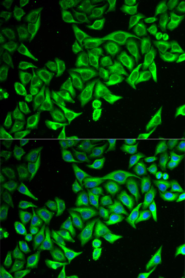 Anti-DAP Antibody (CAB6150)