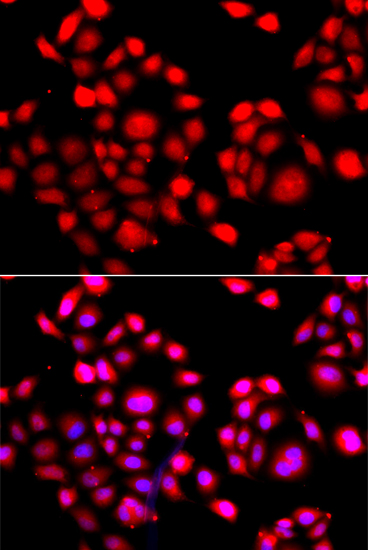 Anti-PRDM14 Antibody (CAB13658)