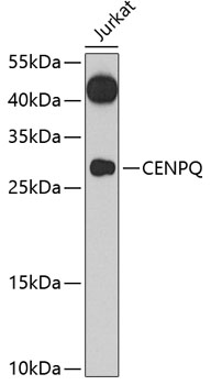 Anti-CENPQ Antibody (CAB7628)