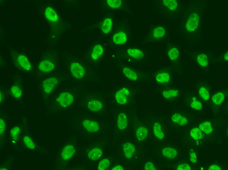 Anti-Chk2 Antibody (CAB2145)