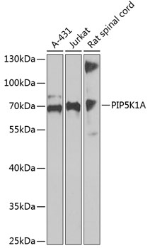 Anti-PIP5K1A Antibody (CAB13374)