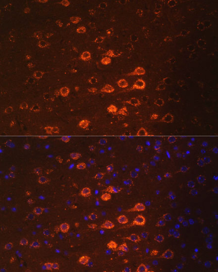 Anti-NEFM Antibody (CAB16405)