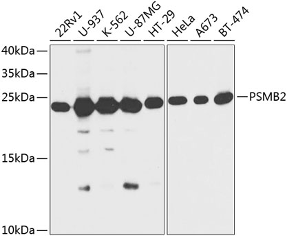 Anti-PSMB2 Antibody (CAB13630)