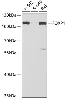 Anti-FOXP1 Antibody (CAB5272)