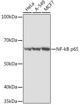 Anti-NF-kB p65 Antibody (CAB16271)