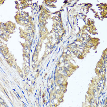 Anti-STK3 Antibody (CAB6992)