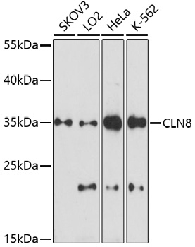 Anti-CLN8 Antibody (CAB16843)