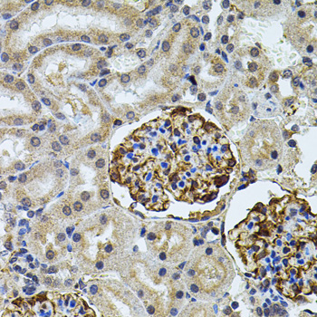 Anti-CETP Antibody (CAB1355)