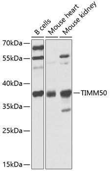 Anti-TIMM50 Polyclonal Antibody (CAB9991)