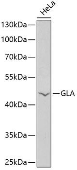 Anti-GLA Antibody (CAB13987)