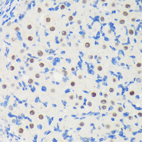 Anti-LARP1B Antibody (CAB13222)