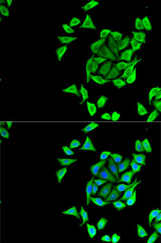 Anti-KCNN3 Antibody (CAB14012)