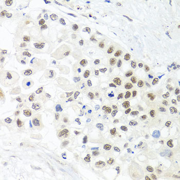 Anti-TRMT1 Antibody (CAB7116)