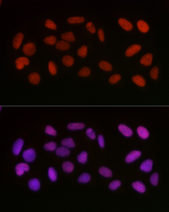 Anti-Acetyl-HMGB1-K29 Antibody [KO Validated] (CAB16002)