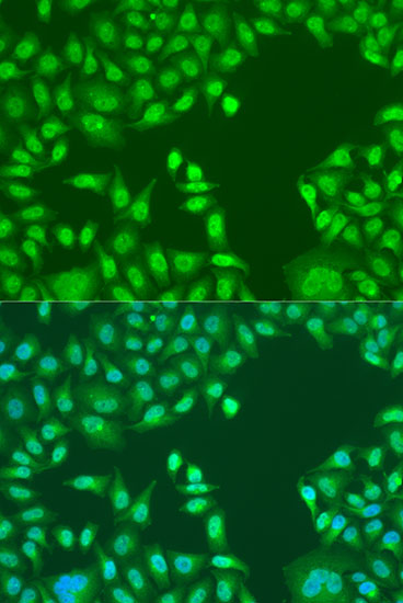 Anti-PTEN Antibody (CAB11528)