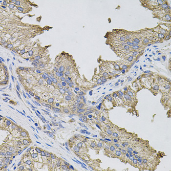 Anti-IFNG Antibody (CAB0242)