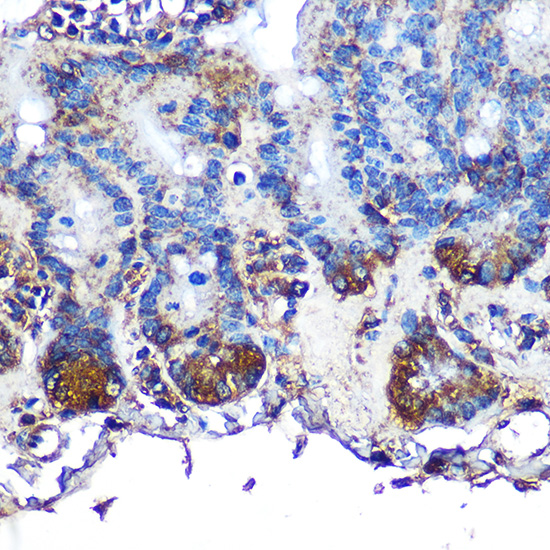 Anti-ITLN1 Antibody (CAB7234)