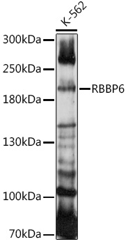 Anti-RBBP6 Antibody (CAB14776)
