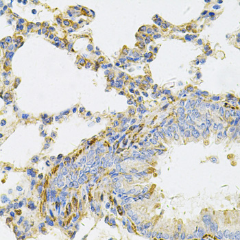 Anti-UBE2B Antibody (CAB6315)