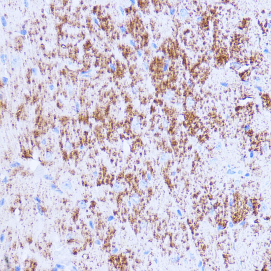 Anti-SIRT3 Antibody (CAB7307)