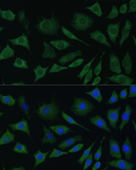 Anti-BMPR1B Antibody (CAB2005)