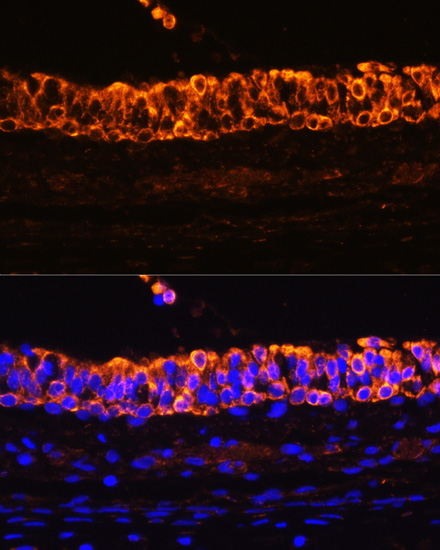 Anti-KRT7 Antibody (CAB12004)