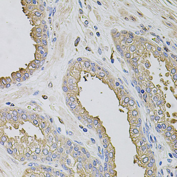 Anti-TRPV3 Antibody (CAB12613)