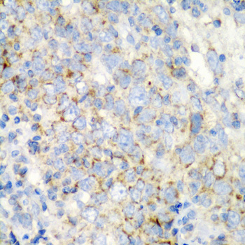 Anti-PRKCQ Antibody (CAB5834)