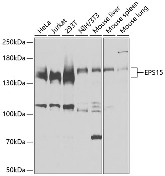 Anti-EPS15 Polyclonal Antibody (CAB9814)