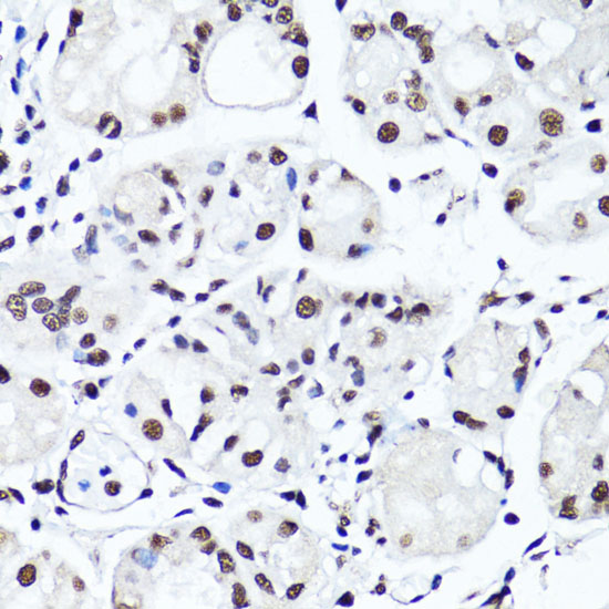 Anti-Symmetric DiMethyl-Histone H4-R3 Antibody (CAB3159)