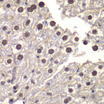 Anti-ST14 Antibody (CAB13549)