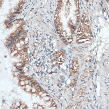 Anti-Aquaporin 4 Antibody (CAB2887)