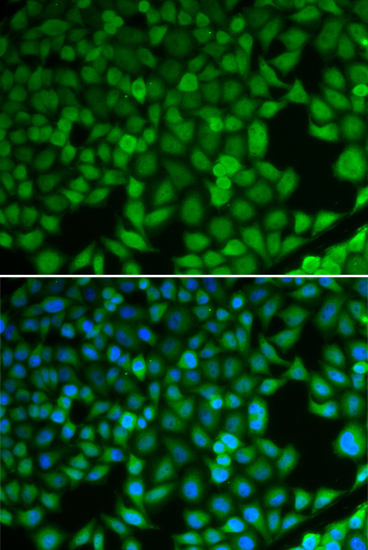 Anti-NDRG1 Antibody (CAB2142)