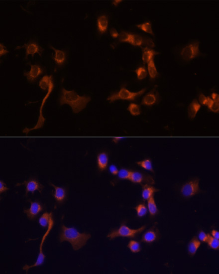 Anti-ABL1 Antibody (CAB0282)